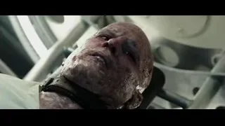 close-up of bloody man in hospital — Deadpool