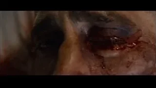 close-up of bruised and bloody eye — Southpaw
